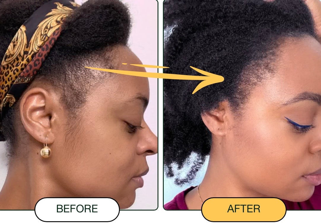 Batana Oil – Nourished Roots, Fuller-Looking Hair