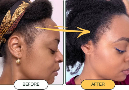 Batana Oil – Nourished Roots, Fuller-Looking Hair