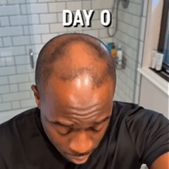 🔥New for 2026 · 60% Off - Rosemary Shampoo for Hair Loss & Hair Fall Control