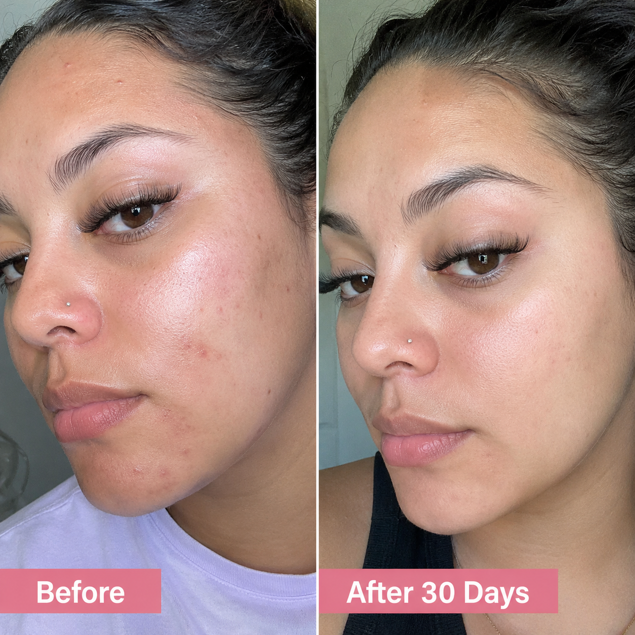 Budevia® Tranexamic Acid & Vitamin C Cream