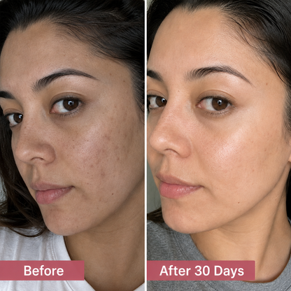 Budevia® Tranexamic Acid & Vitamin C Cream