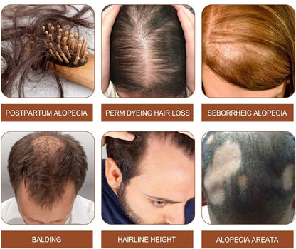 Batana Oil – Nourished Roots, Fuller-Looking Hair