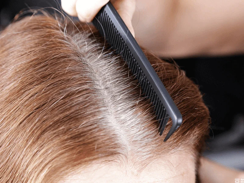 A tight and uncomfortable scalp
